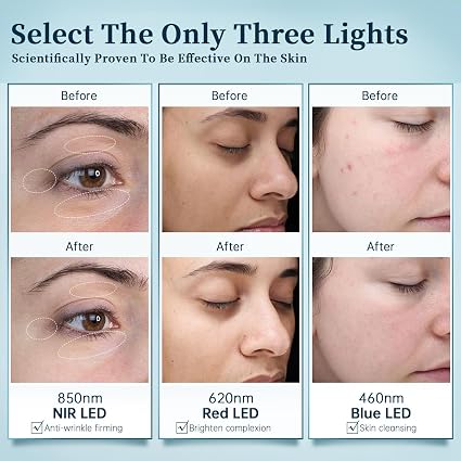 Red Light Therapy for Face, Wireless High Dose Green, Blue, Infrared Mask for Skin Care & Anti-aging